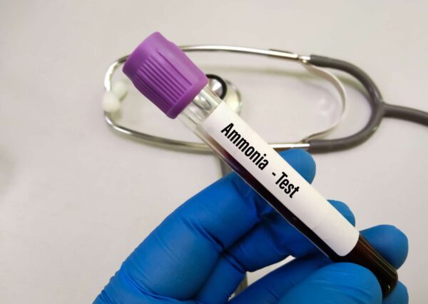 Ammonia Awareness Training
